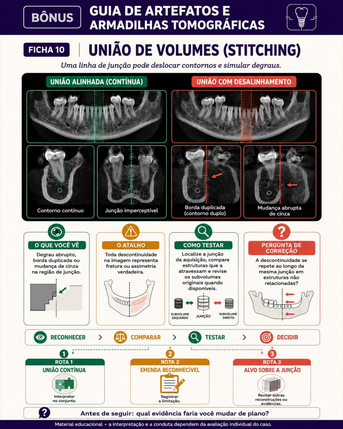 Amostra de leitura tomográfica para Implantodontia