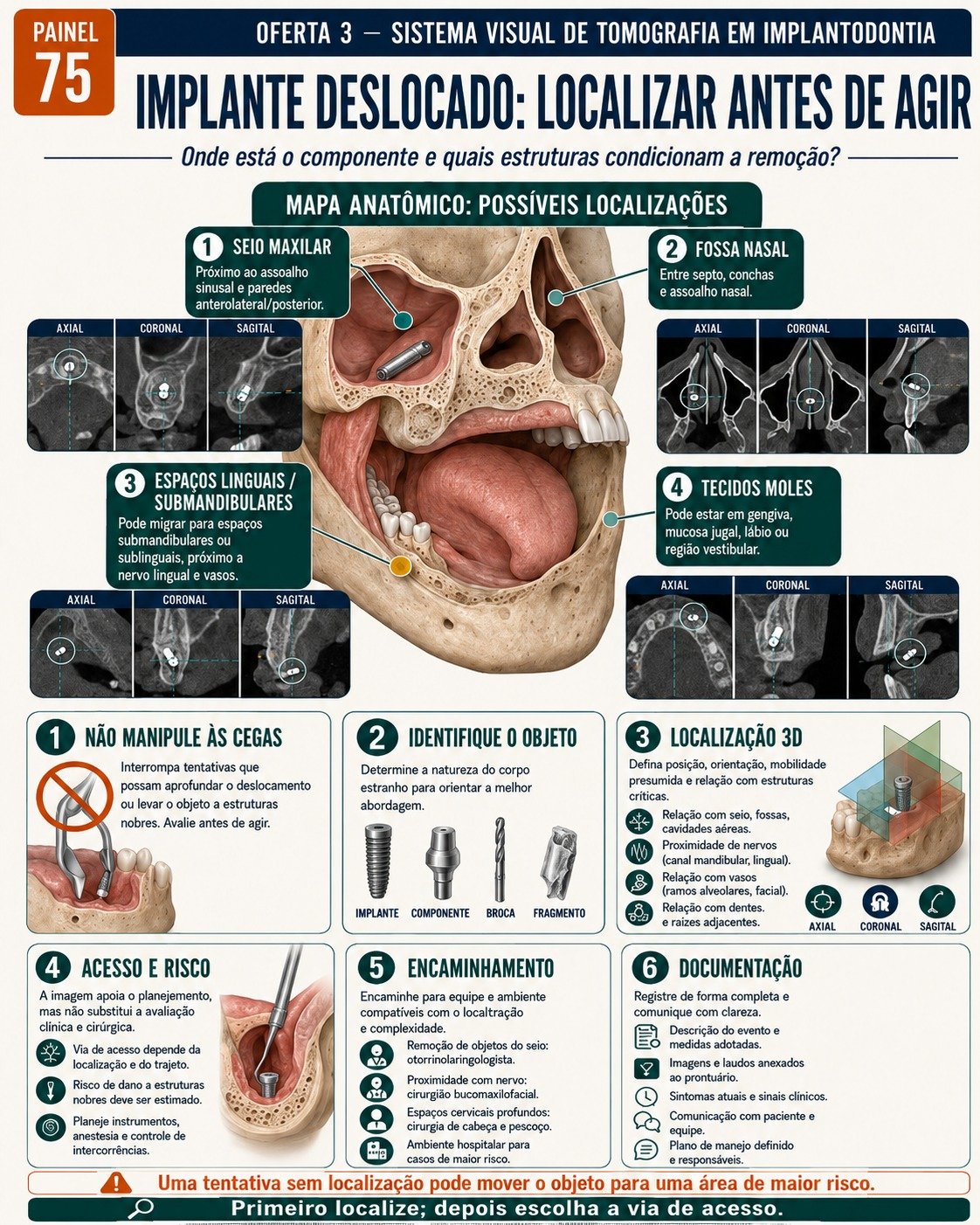 Painel de CBCT aplicada à Implantodontia
